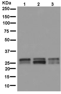 Western blot - Anti-RBPMS2 antibody [EPR13121-88] - BSA and Azide free (AB250346)
