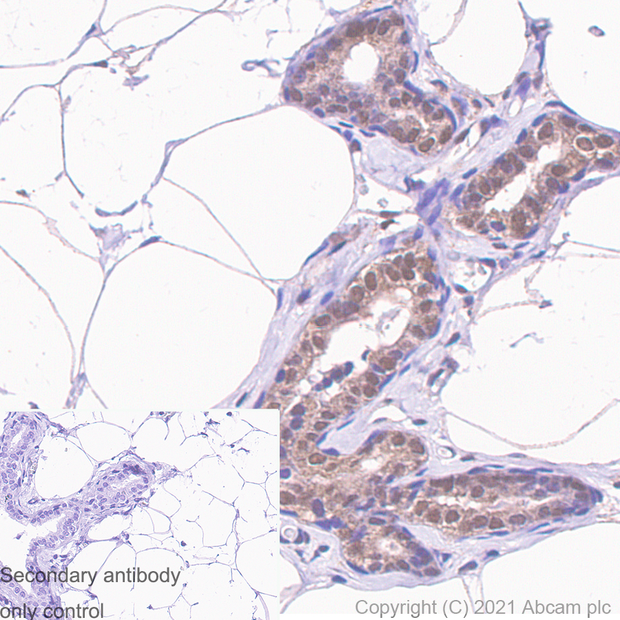 Immunohistochemistry (Formalin/PFA-fixed paraffin-embedded sections) - Anti-RBX1 antibody [EPR6850(B)] (AB133565), expandable thumbnail