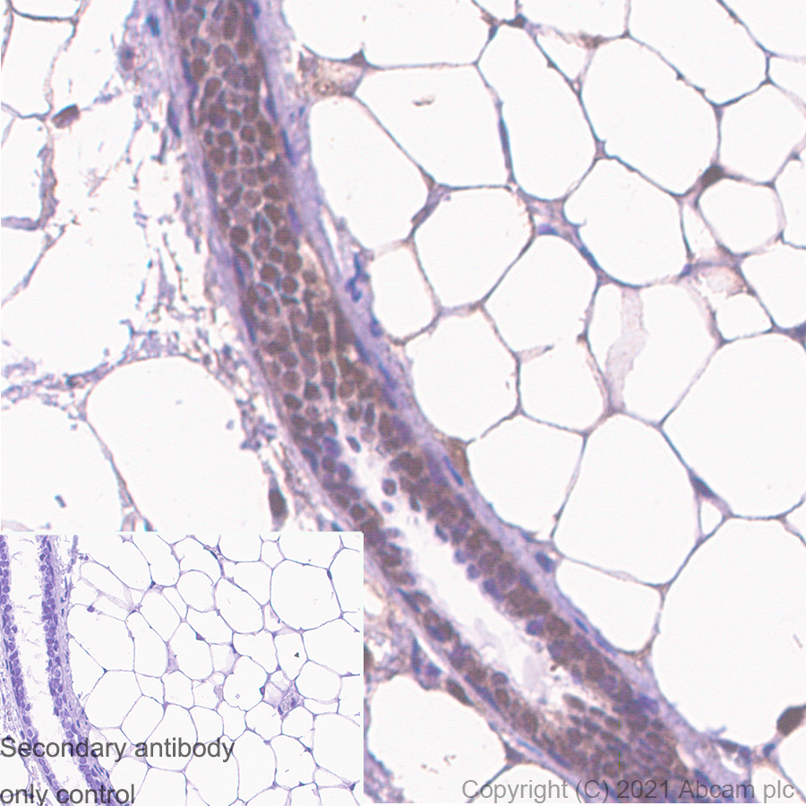 Immunohistochemistry (Formalin/PFA-fixed paraffin-embedded sections) - Anti-RBX1 antibody [EPR6850(B)] (ab133565), expandable thumbnail