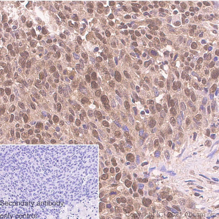 Immunohistochemistry (Formalin/PFA-fixed paraffin-embedded sections) - Anti-RBX1 antibody [EPR6850(B)] - BSA and Azide free (AB248556)