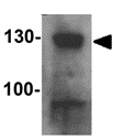 Western blot - Anti-RC3H1 antibody (AB156272)