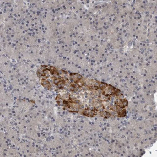 Immunohistochemistry (Formalin/PFA-fixed paraffin-embedded sections) - Anti-RC3H1 antibody (AB244405)