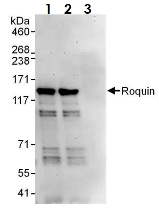 Immunoprecipitation - Anti-RC3H1 antibody (AB70195)