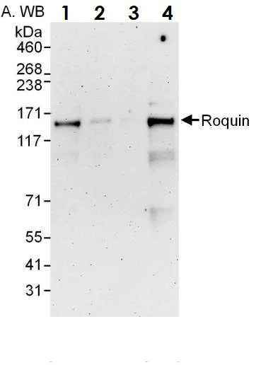 Western blot - Anti-RC3H1 antibody (AB70195)