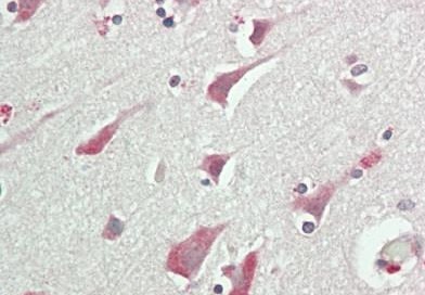 Immunohistochemistry (Formalin/PFA-fixed paraffin-embedded sections) - Anti-RCBTB1 antibody (AB233533)