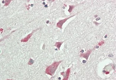 Immunohistochemistry (Formalin/PFA-fixed paraffin-embedded sections) - Anti-RCBTB1 antibody (AB233533)