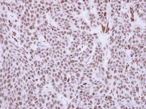 Immunohistochemistry (Formalin/PFA-fixed paraffin-embedded sections) - Anti-RCC1 antibody (AB152156)