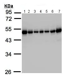 Western blot - Anti-RCC1 antibody (AB152156)