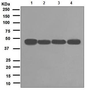 Western blot - Anti-RCC1 antibody [EPR5857] (AB109379)