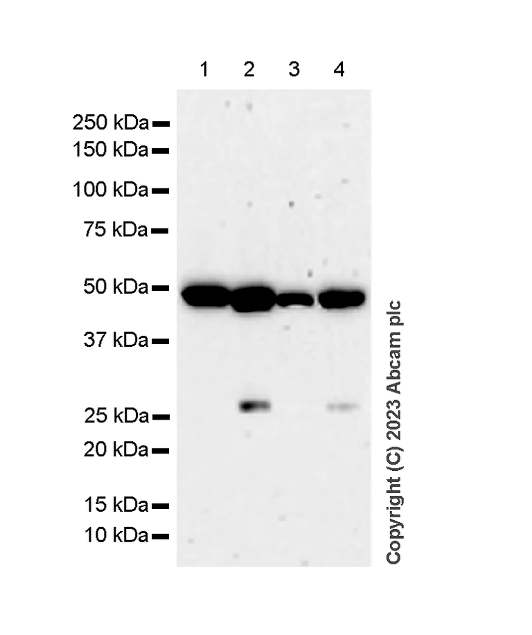 Western blot - Anti-RCC1 antibody [EPR5857] - BSA and Azide free (AB226061)