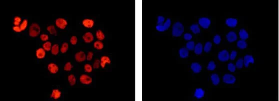 Immunocytochemistry/ Immunofluorescence - Anti-RCC1 antibody [EPR5859(2)] (AB181155)