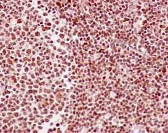 Immunohistochemistry (Formalin/PFA-fixed paraffin-embedded sections) - Anti-RCC1 antibody [EPR5859(2)] - BSA and Azide free (AB250383)
