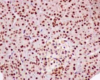 Immunohistochemistry (Formalin/PFA-fixed paraffin-embedded sections) - Anti-RCC1 antibody [EPR5859(2)] - BSA and Azide free (AB250383)