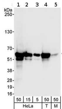 Western blot - Anti-RCC2 antibody (AB70787)