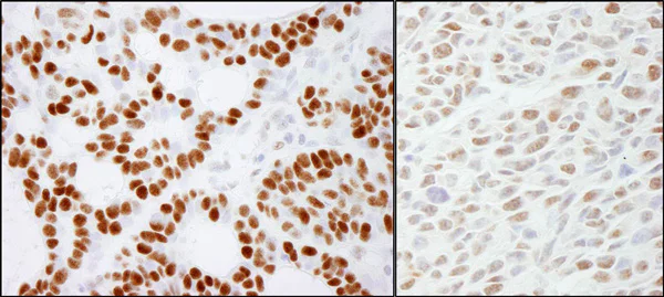 Immunohistochemistry (Formalin/PFA-fixed paraffin-embedded sections) - Anti-RCC2 antibody (AB70788)