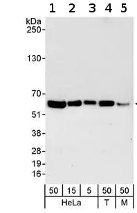 Western blot - Anti-RCC2 antibody (AB70788)