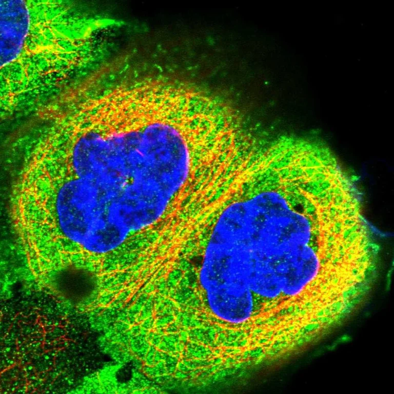 Immunocytochemistry/ Immunofluorescence - Anti-RCCD1 antibody (AB122570)