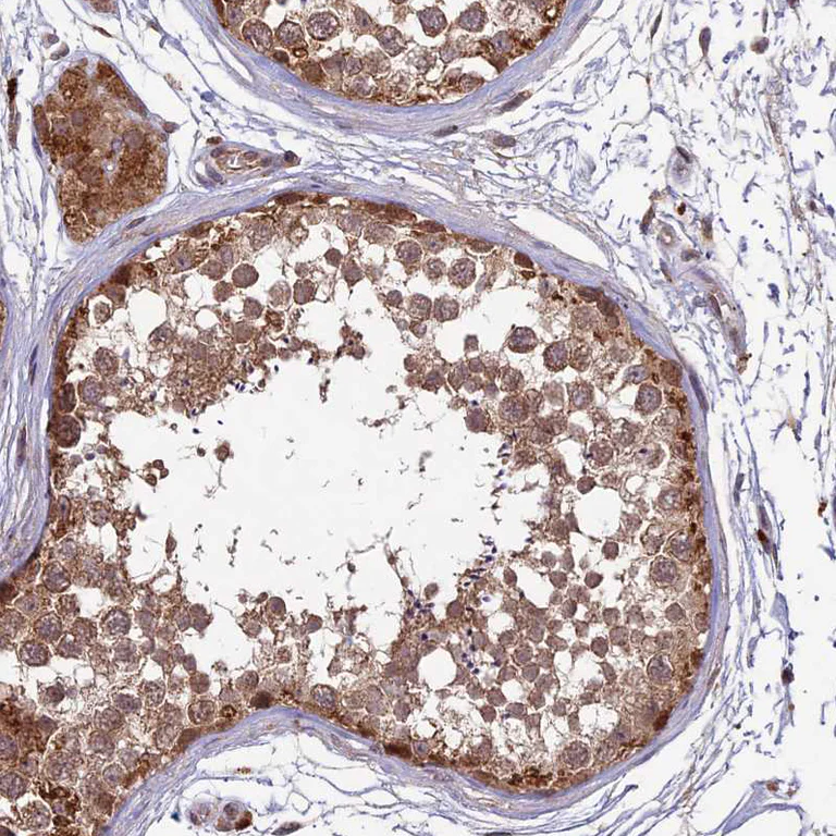 Immunohistochemistry (Formalin/PFA-fixed paraffin-embedded sections) - Anti-RCCD1 antibody (AB122570)