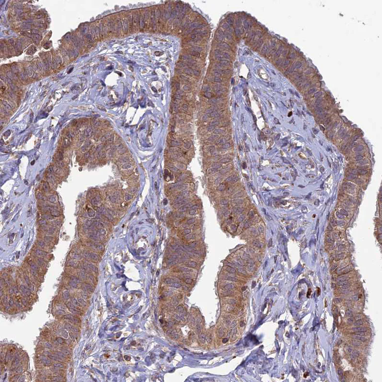 Immunohistochemistry (Formalin/PFA-fixed paraffin-embedded sections) - Anti-RCCD1 antibody (AB122570)