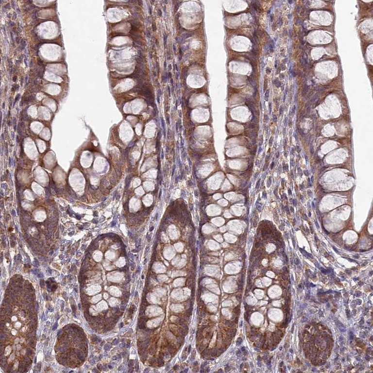 Immunohistochemistry (Formalin/PFA-fixed paraffin-embedded sections) - Anti-RCCD1 antibody (AB122570)