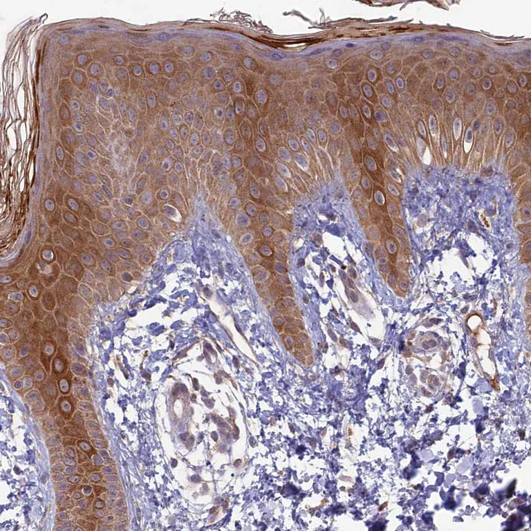 Immunohistochemistry (Formalin/PFA-fixed paraffin-embedded sections) - Anti-RCCD1 antibody (AB122570)