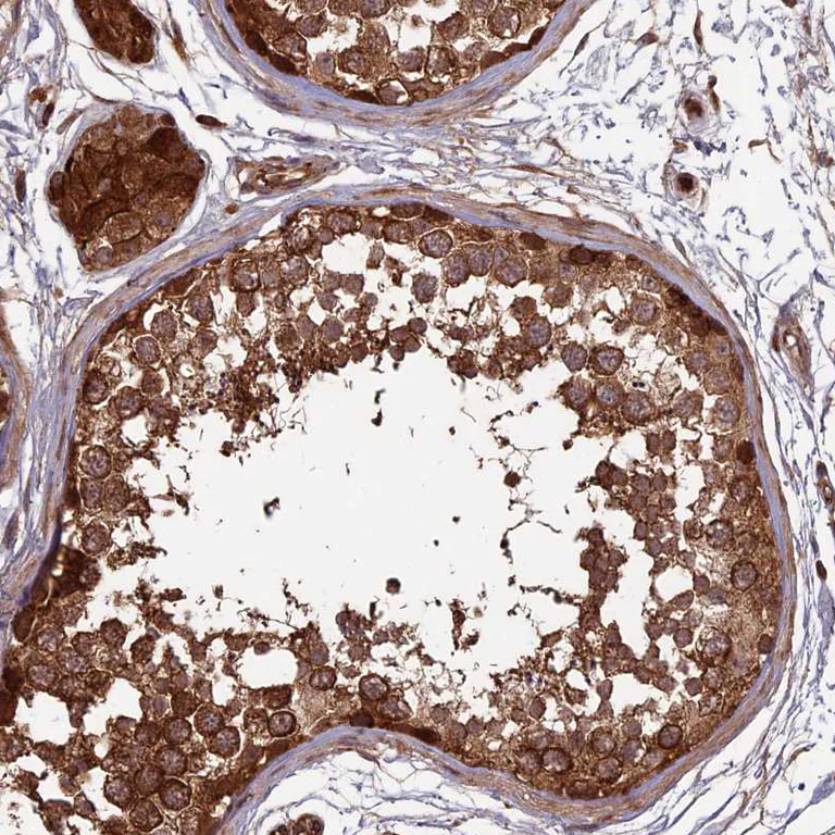Immunohistochemistry (Formalin/PFA-fixed paraffin-embedded sections) - Anti-RCCD1 antibody (AB122667)