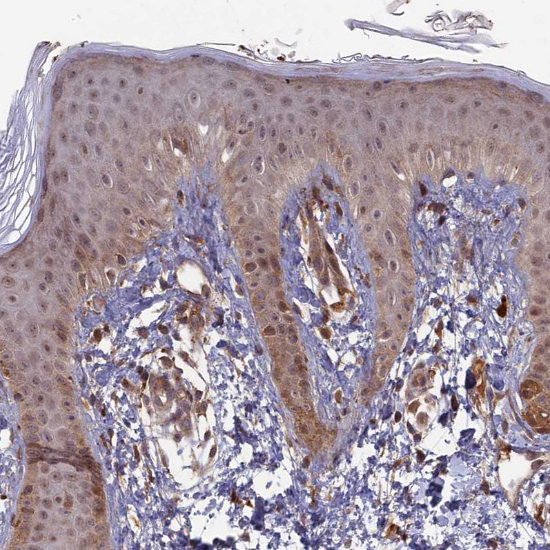Immunohistochemistry (Formalin/PFA-fixed paraffin-embedded sections) - Anti-RCCD1 antibody (AB122667)