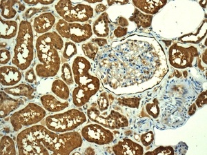 Immunohistochemistry (Formalin/PFA-fixed paraffin-embedded sections) - Anti-RCL antibody [EPR8685] (AB150413), expandable thumbnail