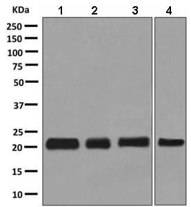 Western blot - Anti-RCL antibody [EPR8685] (AB150413), expandable thumbnail