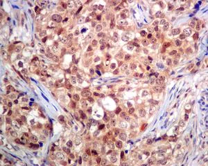 Immunohistochemistry (Formalin/PFA-fixed paraffin-embedded sections) - Anti-RCL antibody [EPR8686] - BSA and Azide free (AB248390)