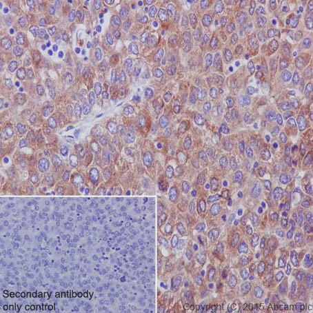 Immunohistochemistry (Formalin/PFA-fixed paraffin-embedded sections) - Anti-RCN1/RCN antibody [EPR17162] (AB205927)
