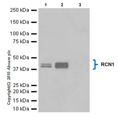 Immunoprecipitation - Anti-RCN1/RCN antibody [EPR17162] (AB205927)
