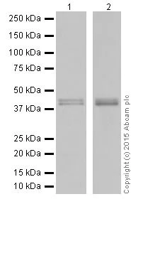 Western blot - Anti-RCN1/RCN antibody [EPR17162] (AB205927)