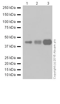 Western blot - Anti-RCN1/RCN antibody [EPR17162] (AB205927)