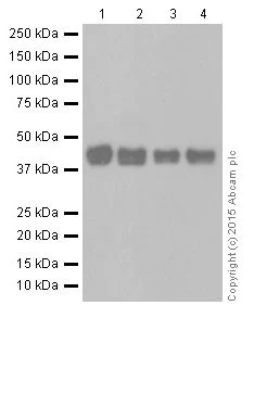 Western blot - Anti-RCN1/RCN antibody [EPR17162] (AB205927)