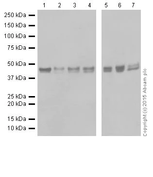 Western blot - Anti-RCN1/RCN antibody [EPR17162] (AB205927)