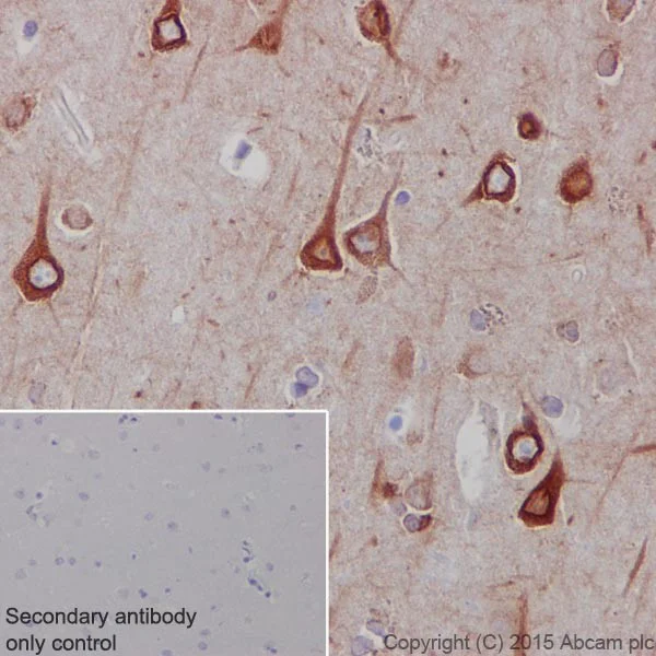 Immunohistochemistry (Formalin/PFA-fixed paraffin-embedded sections) - Anti-RCN1/RCN antibody [EPR17163-117] (AB210404)