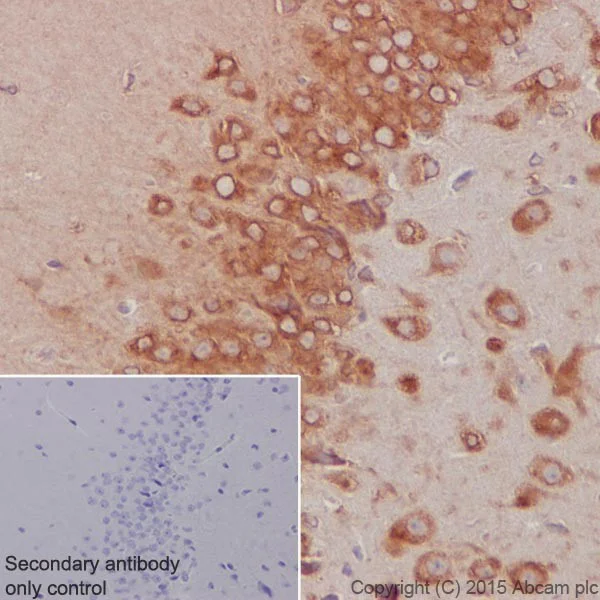 Immunohistochemistry (Formalin/PFA-fixed paraffin-embedded sections) - Anti-RCN1/RCN antibody [EPR17163-117] (AB210404)