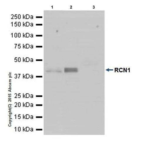 Immunoprecipitation - Anti-RCN1/RCN antibody [EPR17163-117] (AB210404)