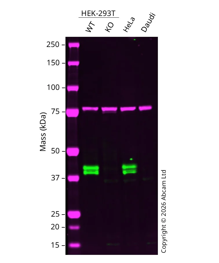Western blot - Anti-RCN1/RCN antibody [EPR17163-117] (AB210404)