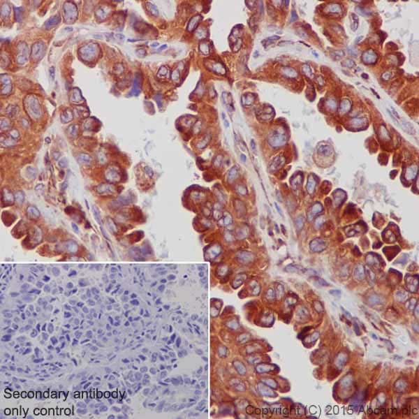 Immunohistochemistry (Formalin/PFA-fixed paraffin-embedded sections) - Anti-RCN1/RCN antibody [EPR17163-117] - BSA and Azide free (ab251515), expandable thumbnail