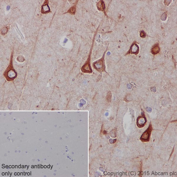 Immunohistochemistry (Formalin/PFA-fixed paraffin-embedded sections) - Anti-RCN1/RCN antibody [EPR17163-117] - BSA and Azide free (AB251515), expandable thumbnail