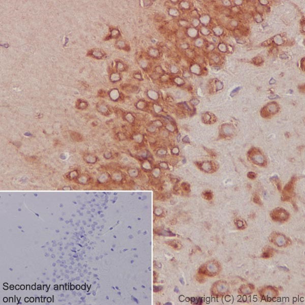 Immunohistochemistry (Formalin/PFA-fixed paraffin-embedded sections) - Anti-RCN1/RCN antibody [EPR17163-117] - BSA and Azide free (ab251515), expandable thumbnail