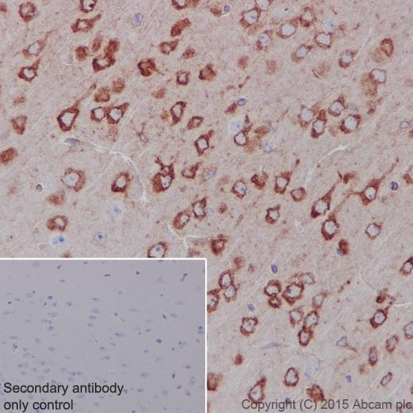 Immunohistochemistry (Formalin/PFA-fixed paraffin-embedded sections) - Anti-RCN1/RCN antibody [EPR17163-117] - BSA and Azide free (ab251515), expandable thumbnail