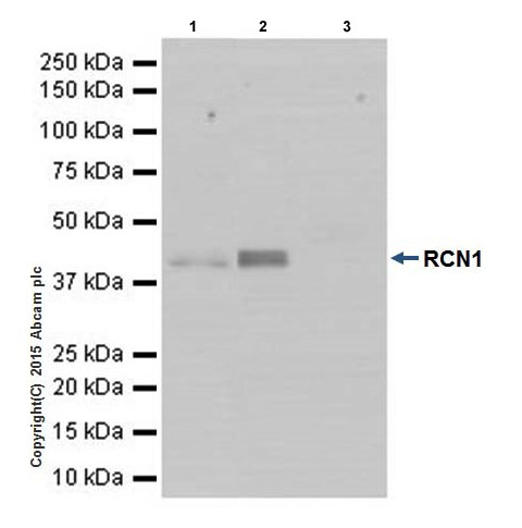 Immunoprecipitation - Anti-RCN1/RCN antibody [EPR17163-117] - BSA and Azide free (ab251515), expandable thumbnail