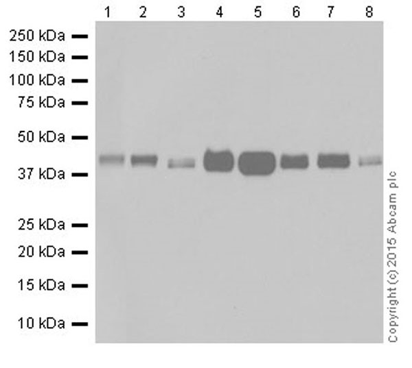 Western blot - Anti-RCN1/RCN antibody [EPR17163-117] - BSA and Azide free (AB251515), expandable thumbnail