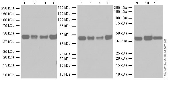 Western blot - Anti-RCN1/RCN antibody [EPR17163-117] - BSA and Azide free (AB251515), expandable thumbnail