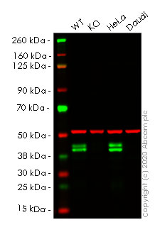 Western blot - Anti-RCN1/RCN antibody [EPR17163-117] - BSA and Azide free (AB251515), expandable thumbnail