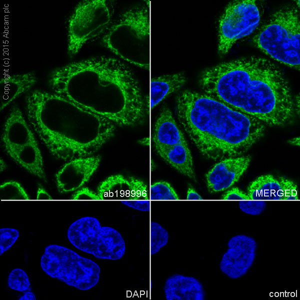 Immunocytochemistry/ Immunofluorescence - Anti-RCN1/RCN antibody [EPR17163] - C-terminal (AB198996), expandable thumbnail
