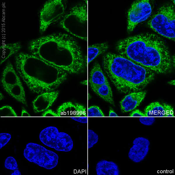 Immunocytochemistry/ Immunofluorescence - Anti-RCN1/RCN antibody [EPR17163] - C-terminal (AB198996)